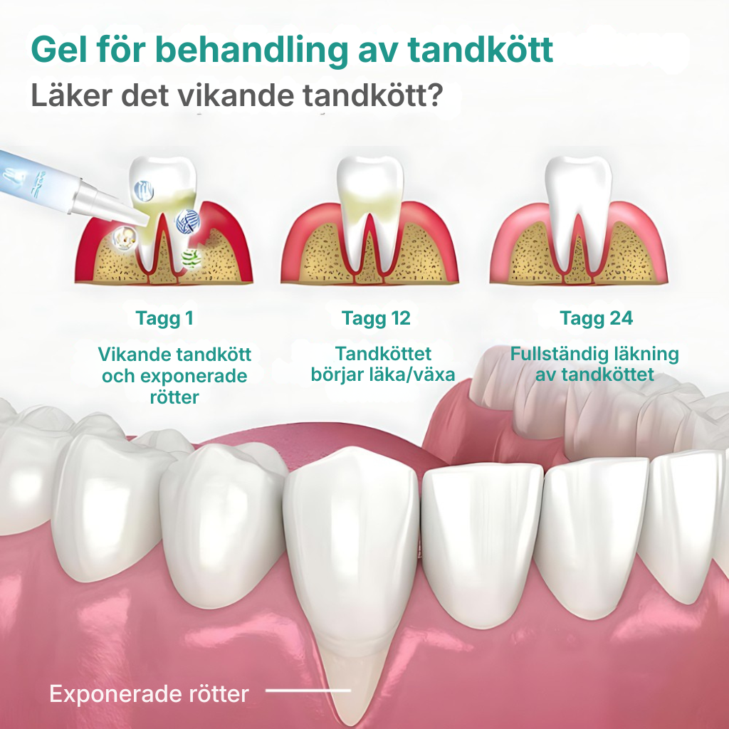Gum Protect Gel | Hjälper till att stärka tandköttet och ge vitare tänder
