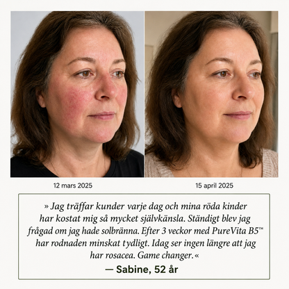 PureVita B5™ Serum mot rodnad