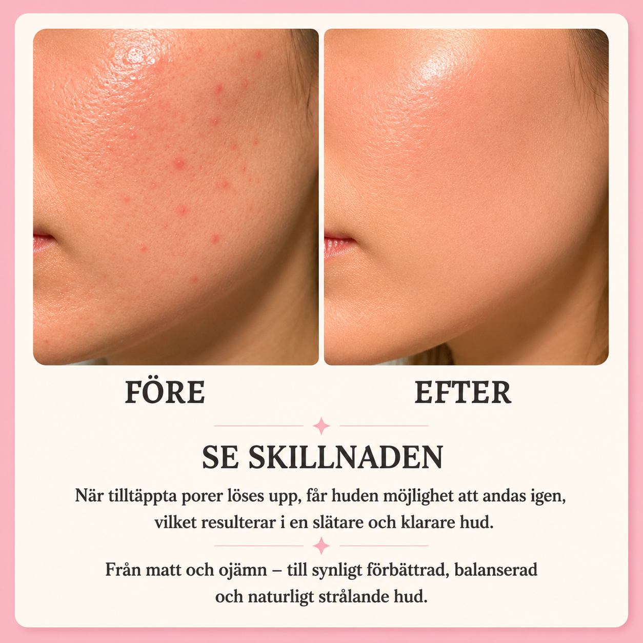 SilkSkin™– Klarare hud utan synliga porer