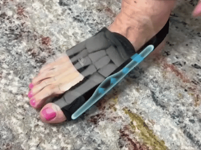 ToeRelief™ Hallux Valgus-korrigerare | Korrigera tåställningen på bara 14 dagar