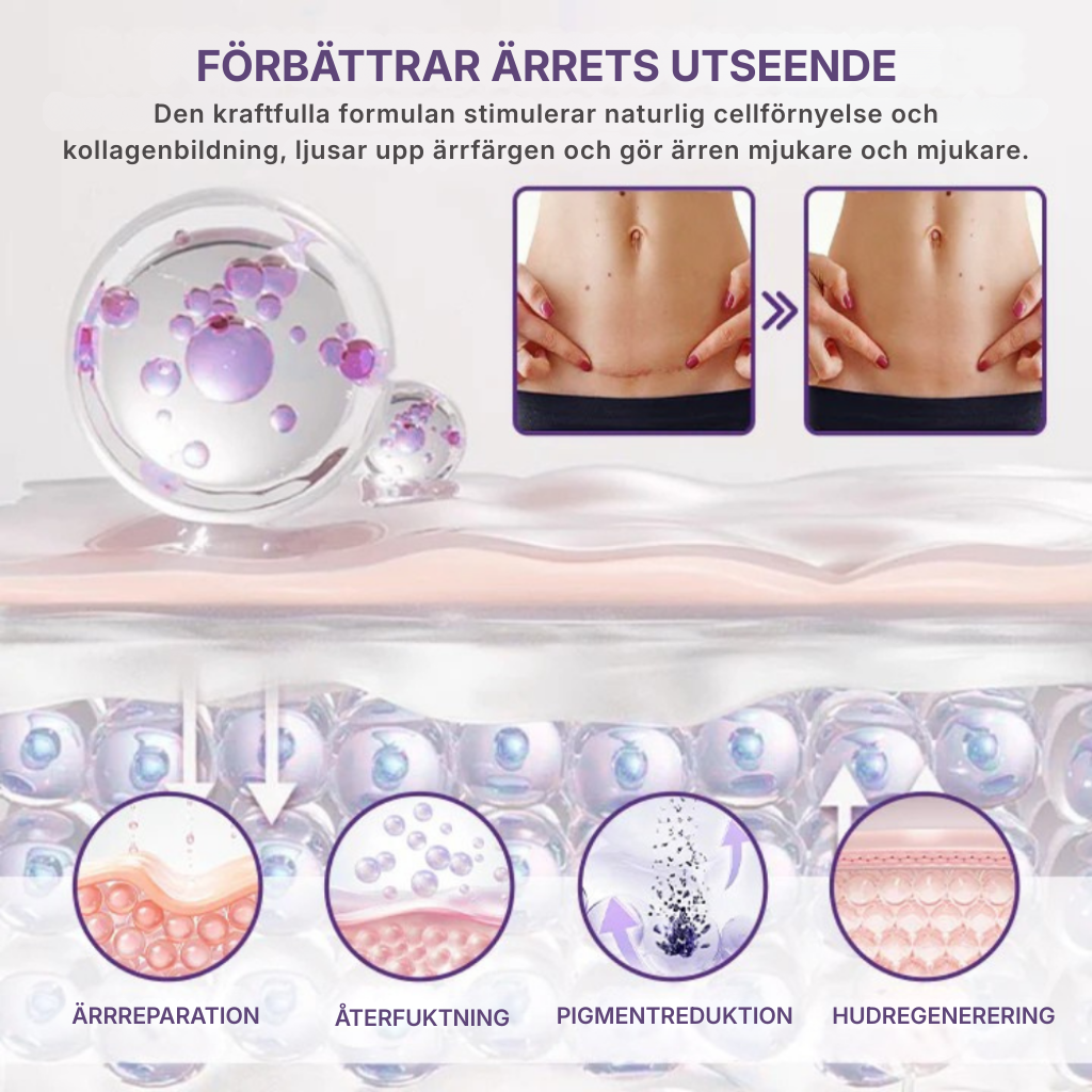 DermaVie™ | Gör synliga ärr mjukare och mindre framträdande