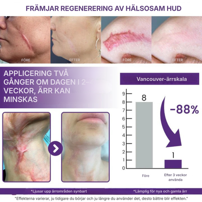 DermaVie™ | Gör synliga ärr mjukare och mindre framträdande