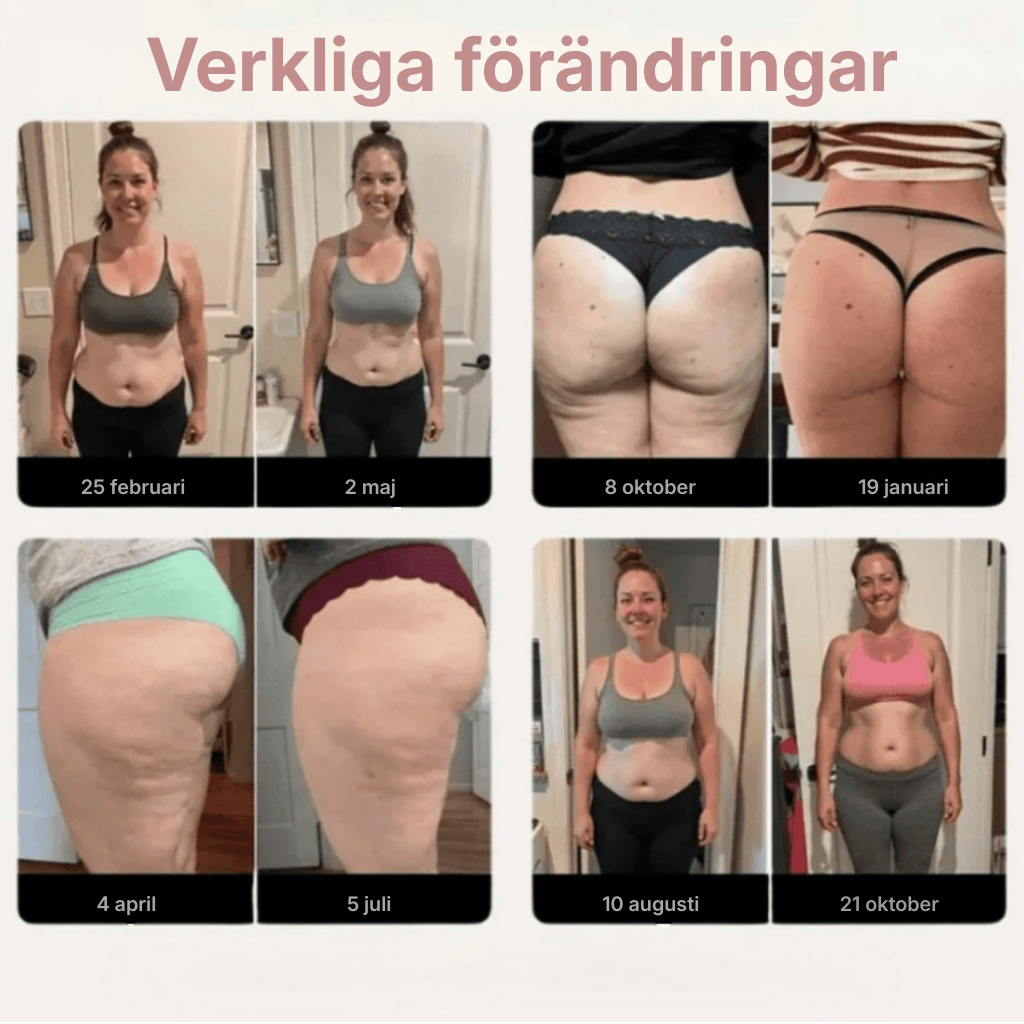 Velisse™ | Leggings som aktivt motverkar celluliter