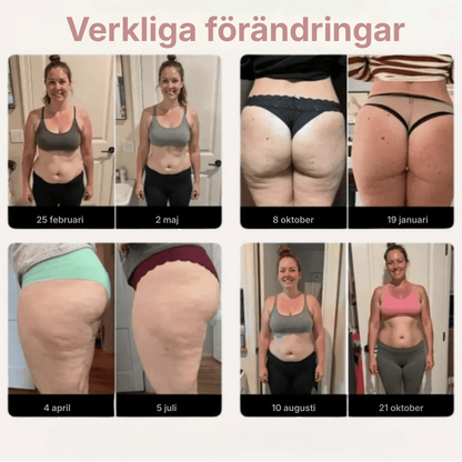 Velisse™ | Leggings som aktivt motverkar celluliter